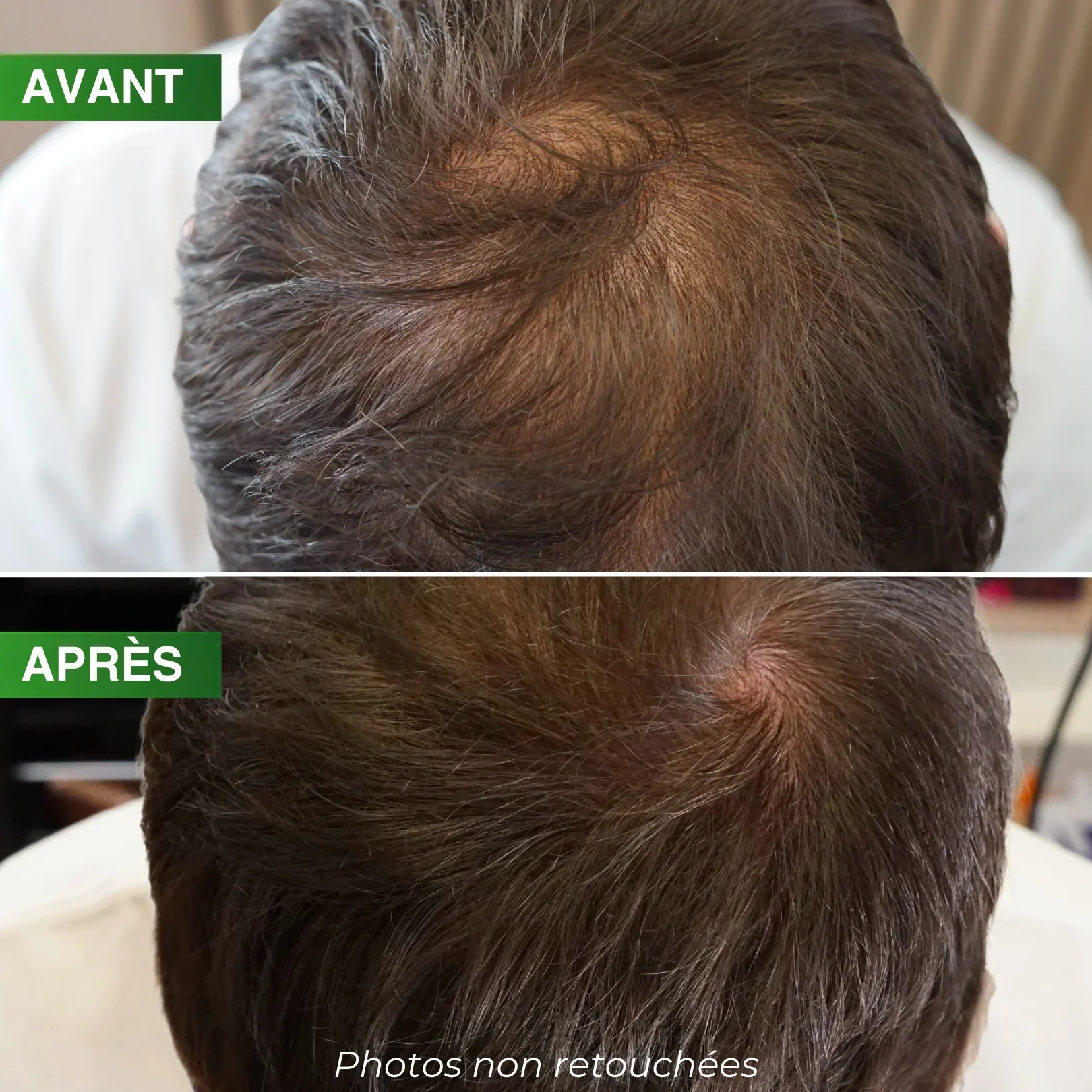 Spray Ancrage Densité Pro BBHAIR Generik 100 ML - Image 2